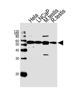 ULK3 Antibody (C-term)