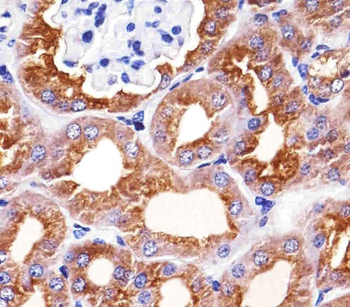 PAH Antibody (Center)