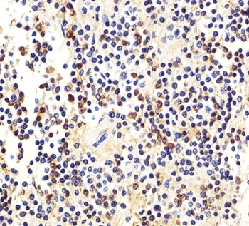 MME Antibody (N-term)