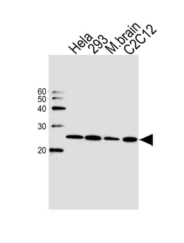 HIP2 (UBE2K) Antibody(N-term)