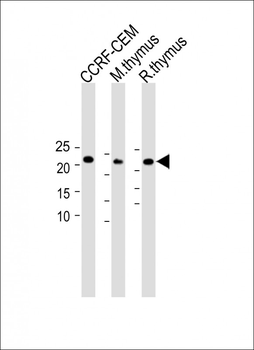 CD3E antibody (C-term)