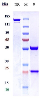 TPSAB1 Reference Antibody
