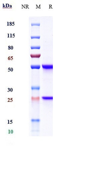 Amyloid Beta Reference Antibody (Amyloid beta 19.3)