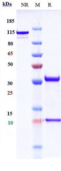 ERBB1 / EGFR / HER1 Reference Antibody (nimotuzumab)