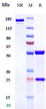 TNFSF7 / CD27L / CD70 Reference Antibody (Vorsetuzumab mafodotin)