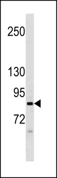 NALD2 Antibody (C-term)