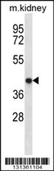 TNMD Antibody (Center)