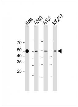 PD L1 Antibody (C-Term)