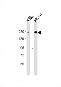 XRN1 Antibody