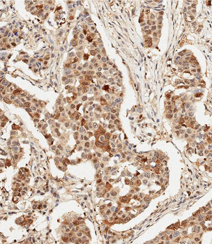 HSPA1A/HSPA1B Antibody (Y41)