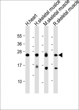 MYL1 Antibody (Center)
