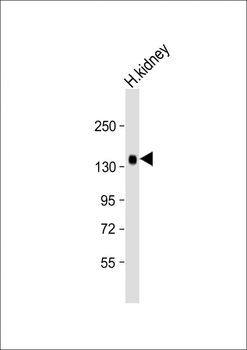 KL Antibody (Center)