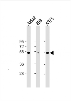RBCK1 (UBCE7IP3) Antibody
