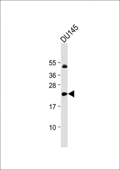 IL11 Antibody (N-Term)