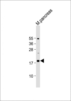 IL23A Antibody (Center)