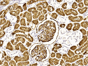 MME Antibody (Center)