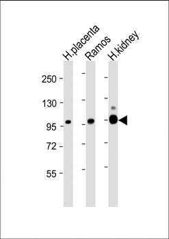 MME Antibody (Center)