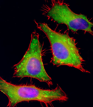 PGAP1 Antibody (N-Term)