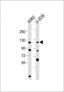 NOP2 Antibody (N-Term)