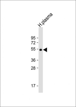 GC Antibody (N-Term)