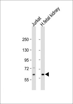 EPHX2 Antibody (N-Term)