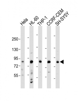 LRCH4 Antibody (Center)