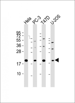 ANAPC11 Antibody (C-Term)