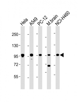 PCSK1 Antibody (C-Term)