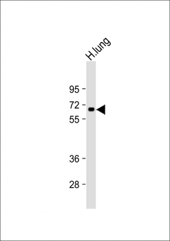 CSRNP1 Antibody (C-Term)