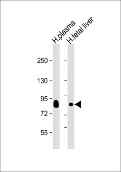Transferrin Antibody