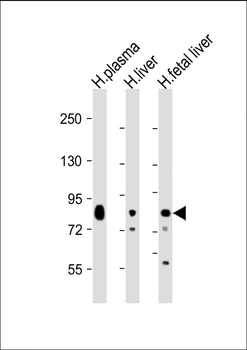 Transferrin Antibody
