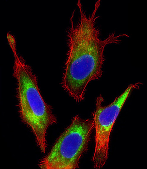 Transferrin Antibody