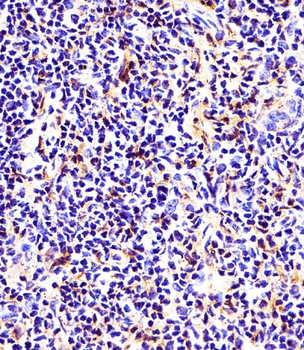beta Tubulin Antibody