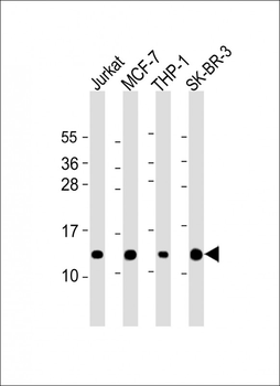 RPS27 Antibody (N-Term)