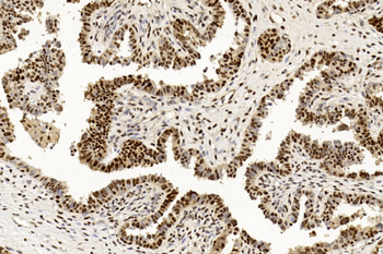 PCNA Antibody [Knockout Validated]