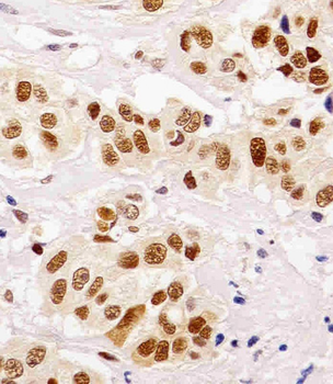 PCNA Antibody [Knockout Validated]