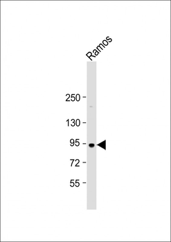 NUGGC Antibody (N-Term)