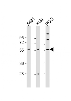 CCT8L2 Antibody (C-Term)