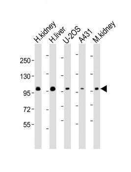 ACO1 Antibody (Center)