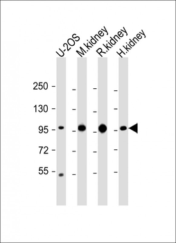 ACO1 Antibody (N-Term)