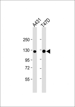 CADH1 Antibody