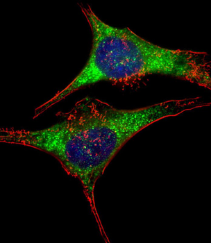 GARS Antibody