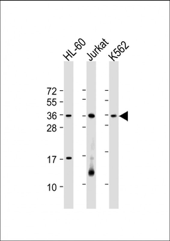 RSPO1 Antibody (C-Term)