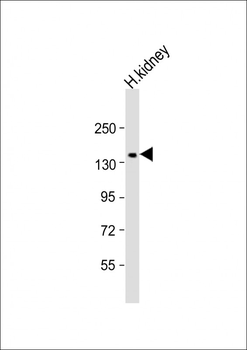 COL4A3 Antibody (N-Term)