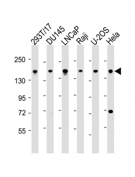 PDS5B Antibody (C-Term)