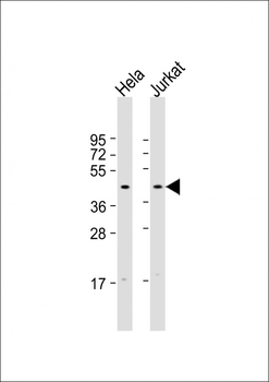 FBXO32 Antibody (N-Term)