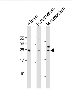 KCTD11 Antibody (N-Term)