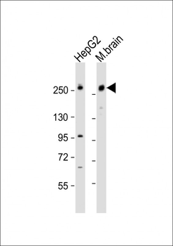 RALGAPA1 Antibody (N-Term)