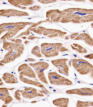 MKRN2 Antibody