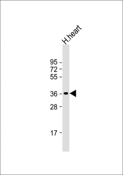 HUMAN-LDHB(Y240) Antibody